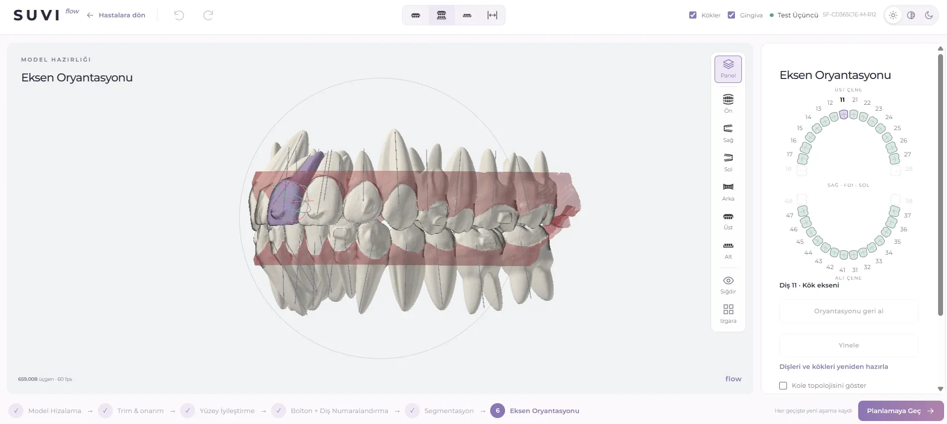 Pianificazione digitale di denti e radici nella schermata di orientamento degli assi di Suvi Flow